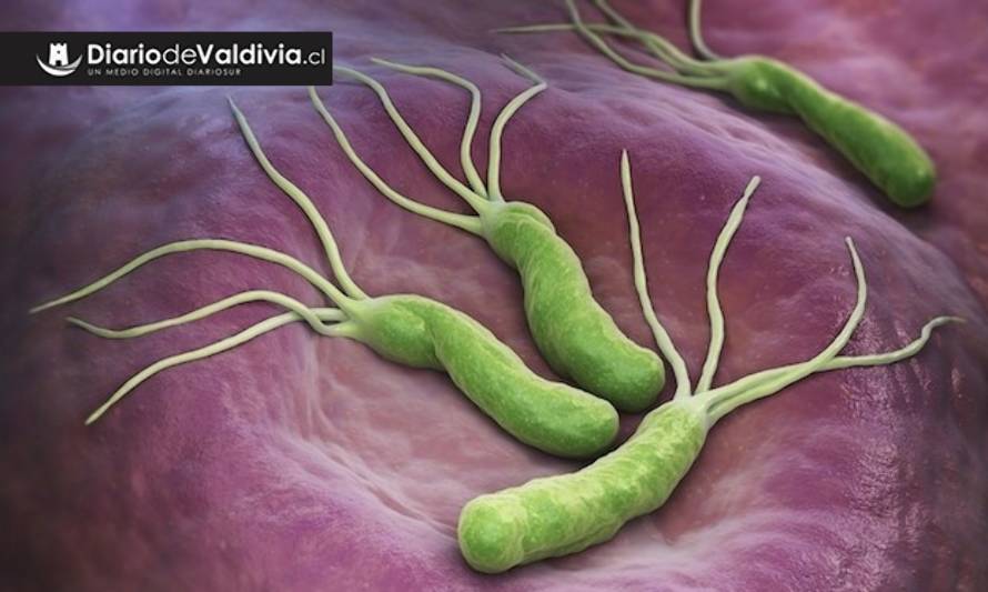 Gastroenterólogos advierten que un 70% de la población chilena porta la bactería helicobacter pylori